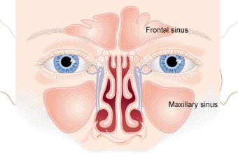 Sinüs Enfeksiyonu Sinüzit