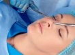 Burun Estetiği Doktor Seçimi